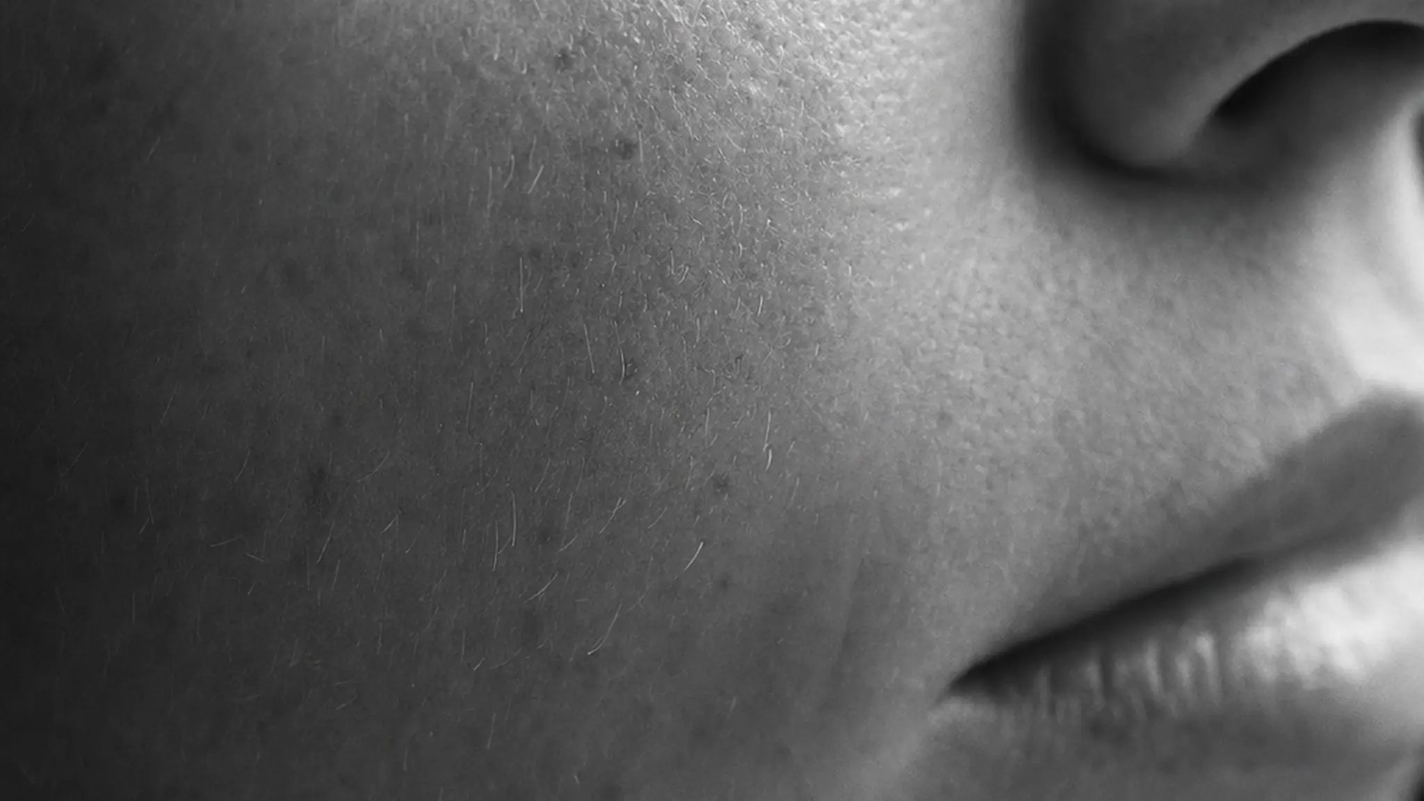 Real skin in winter — documentary portrait for the Activ O₂ Winter 2026
Project.