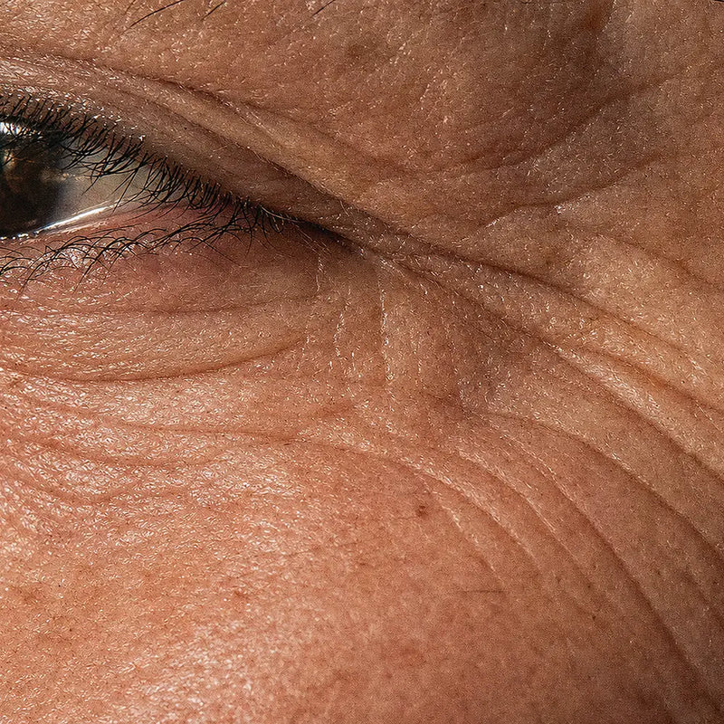 concern ageless